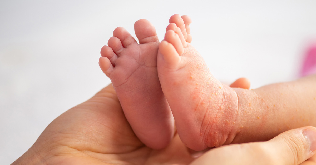 Atlanta Allergy & Asthma News